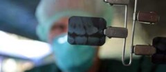 radiografia-odontologia-pinhais-1379438346